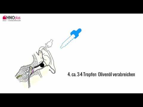 Ohrenschmalz entfernen