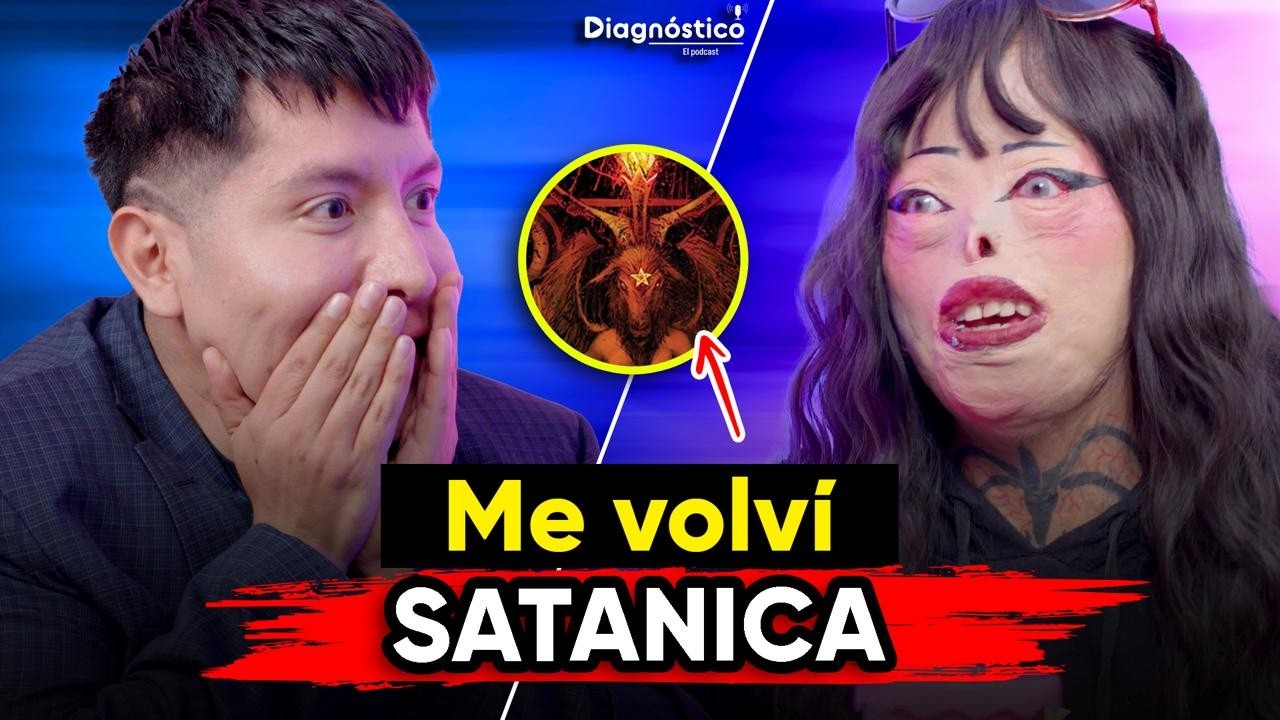 🔥 Tengo QUEMADURAS en TODO mi CUERPO por culpa de mi HERMANO | #Diagnóstico 143 | Mr Doctor