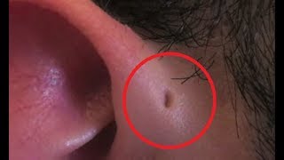 Most RARE Body Features