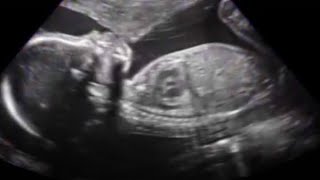Baby Girl ULTRASOUND at 23 Weeks Pregnant, Second Trimester | 3D 4D
