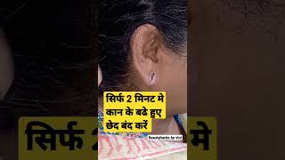Ear pasting #earloberepair #shorts #beautyhacksbyvini #trending #viral #yt20