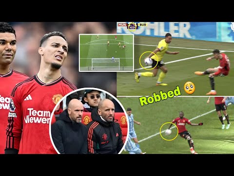 VAR EXPOSED 😱 | Manchester United Robbed vs Burnley 🥺 This was a Penalty 😳 | Handball