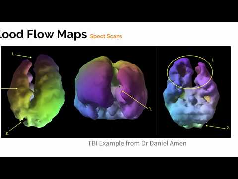 LiveO2 Brain Oxygenation