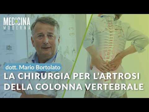 La chirurgia per l'artrosi della colonna vertebrale - Dott. Mario Bortolato
