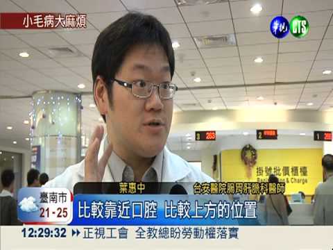 吞嚥困難喉嚨痛 小心食道癌上身!