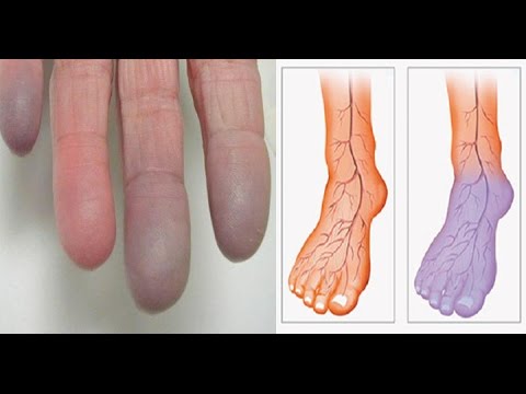 Penis plastica per gli uomini Problemi con la potenza
