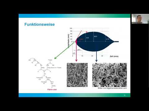 Fasttrack Video - ROTEM® / TEG® ganz einfach erklärt (von Prof. Wolf Hautz)