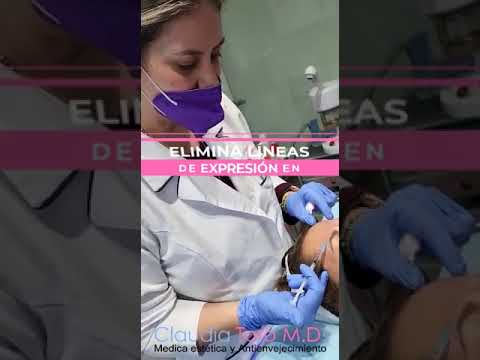 Toxina botulínica en bogotá aplicado por la Dra. Claudia Toro médica estética antienvejecimiento
