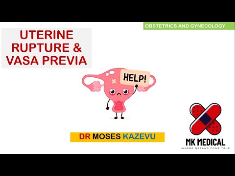 Vasa Previa & Uterine Rupture