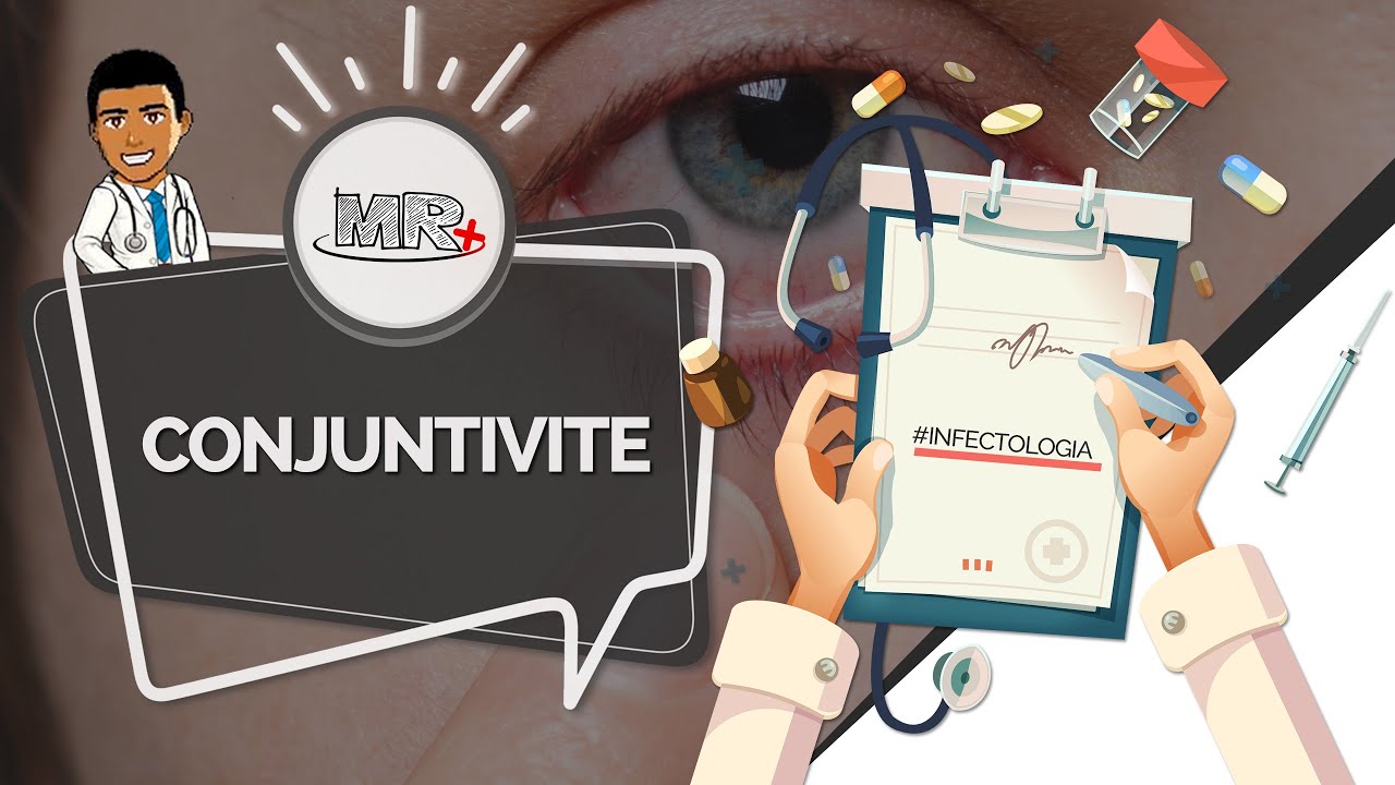Conjuntivites - Aula de revisão de Clínica Médica do MR Plus