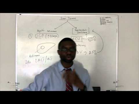 Hepatocellular Carcinoma