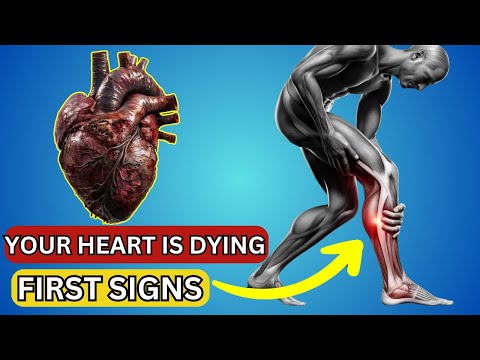 HEART IS DYING! 12 Weird Signs Of HEART DAMAGE | Health