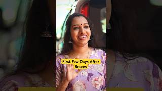 Download lagu Braces Life 😧 #teethbraces #shortsindia mp3