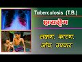 क्षयरोग TB In Nepali Tuberculosis Symptoms Causes And Treatment In Nepali TB By Naya H