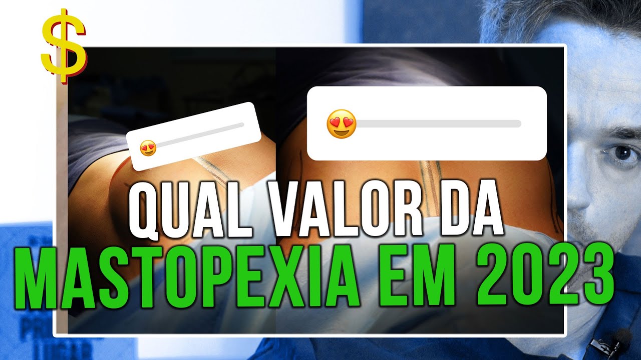 QUAL VALOR MASTOPEXIA 2023 - CIRURGIA PLÁSTICA