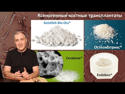 Направленная Костная Регенерация (НКР) 3. Алло- и Ксеногенные (Аллопластические) трансплантаты.