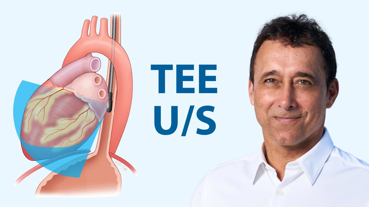 Webinar: Overcoming Barriers to Resuscitative TEE Training