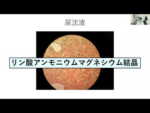 看護学科 今日のグラム染色この一枚 Proteus mirabilisによる尿路感染症