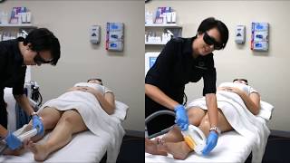 The Global Beauty Group  3 Business Benefits - IPL vs SHR