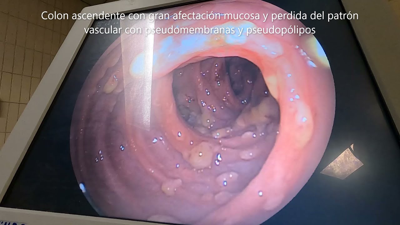 J. César Reyes Vásquez-34