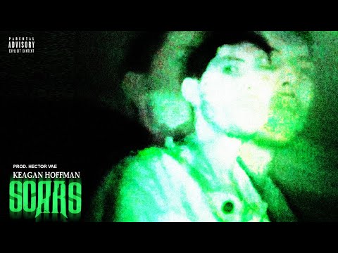 Keagan Hoffman - Scars (Official Music Video)