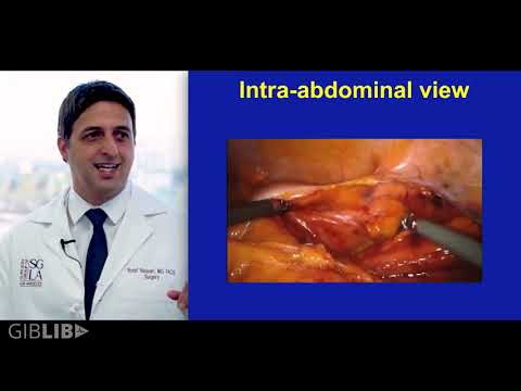 Patient Education: Colorectal Health
