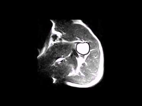 A ciò che il medico di andare con il mal di schiena in gravidanza Dolore nella parte posteriore della testa e del collo a causa del dente