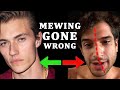 10 Mewing Mistakes That WILL RUIN YOUR FACE