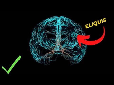 Eliquis: A Breakthrough Blood Thinner for Stroke Prevention