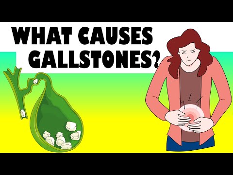What Causes Gallstones? Major Causes Of Gallstone Disease |Gallstones Causes
