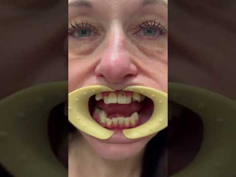 Short-form video for Oral Surgery