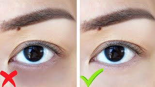 HOW TO: Get Rid Of Dark Circles WITHOUT MAKEUP!