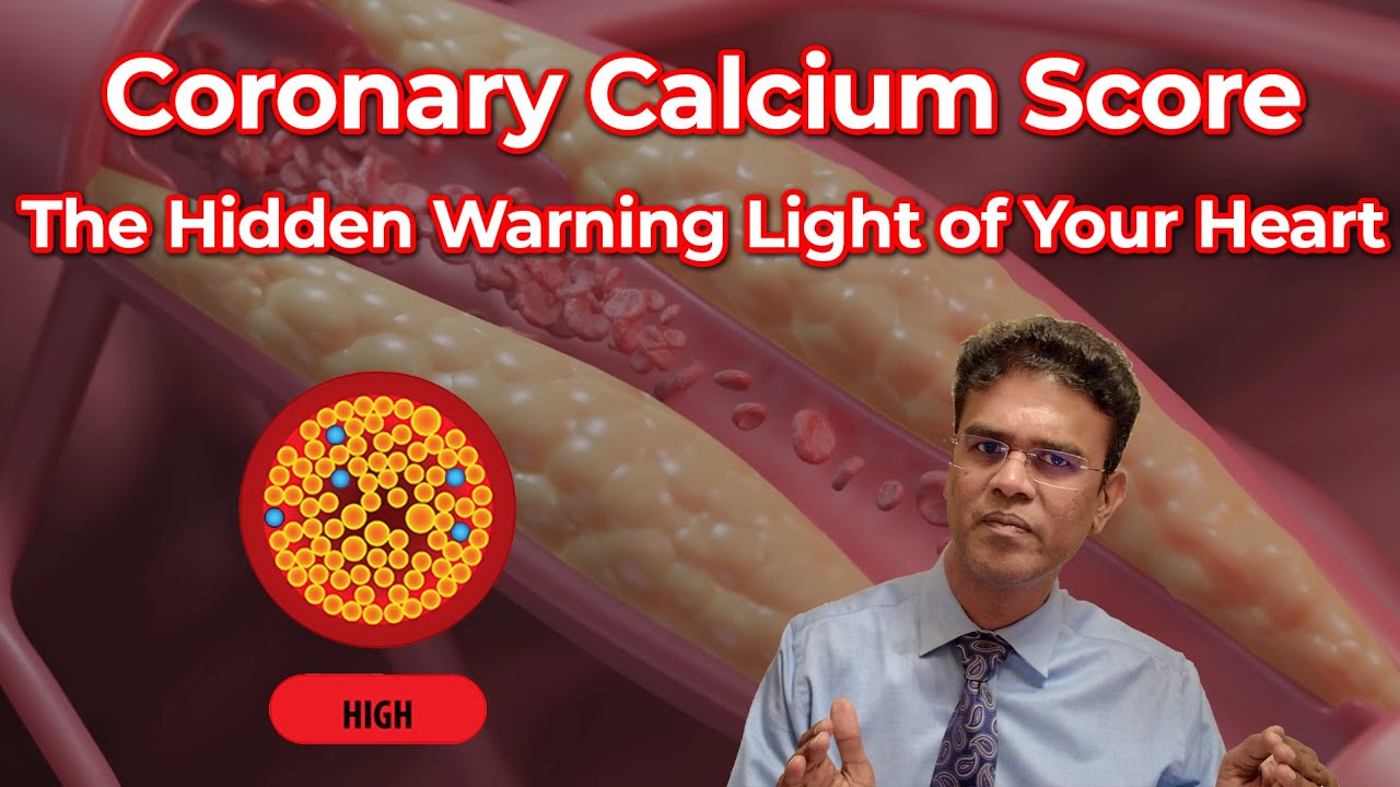 Coronary Calcium Score