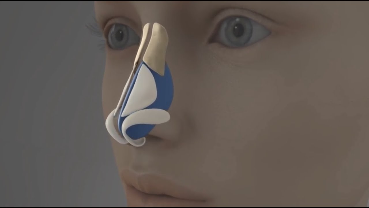 Christoffer Ingves-30