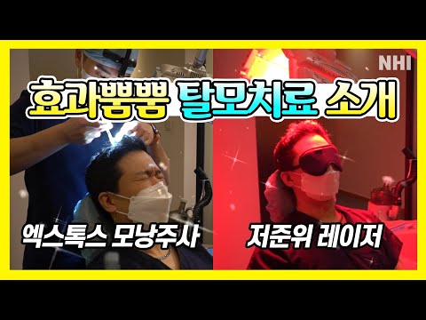 효과만점! 탈모치료의 모든 것ㅣ엑스톡스(보톡스,엑소좀)ㅣ뉴헤어