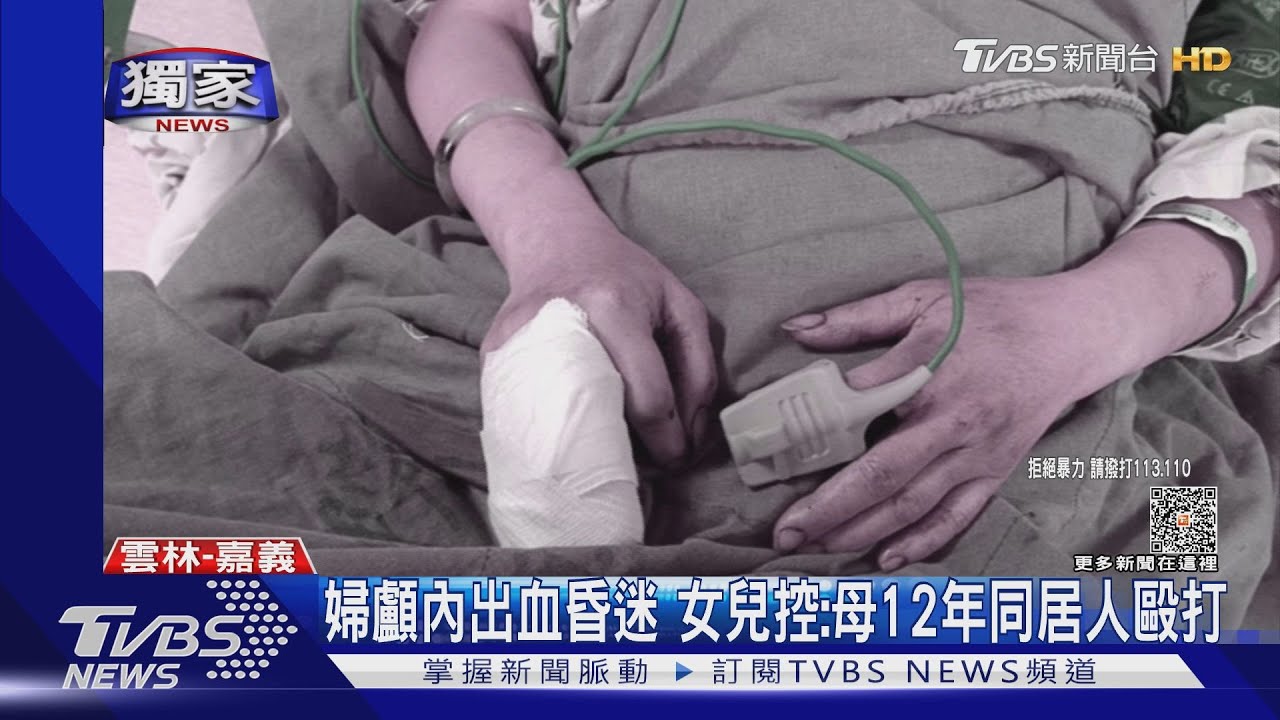 婦被打成遍體鱗傷 法院裁定12年同居人收押