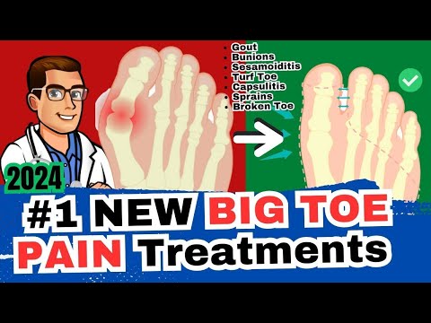 , title : '#1 Big Toe Joint Pain Cure [Arthritis? Sesamoiditis? Turf Toe? Gout?]'