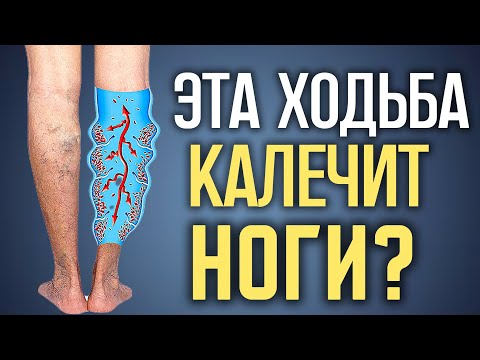 После 60 НЕЛЬЗЯ так ходить! Это разрушает здоровье и суставы!