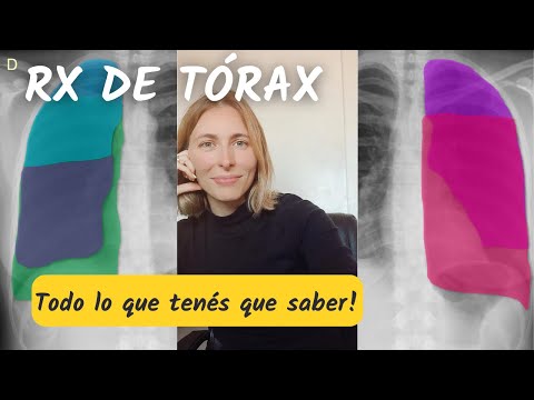 Radiografía de tórax⚕️: Reconoce la anatomía para dominar este método!
