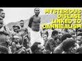 The MYSTERIOUS Disease that Emerged When People Ate People