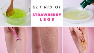 Get Rid Of Strawberry Legs