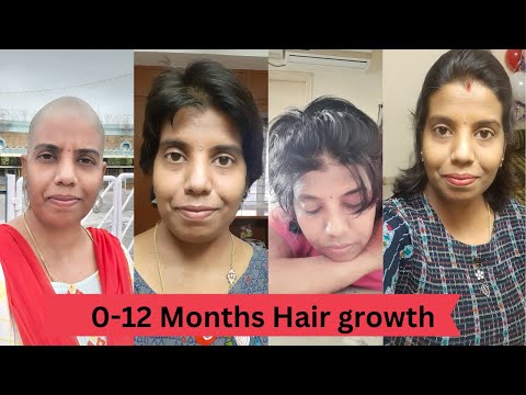 month 0 to month 12 hair growth || headshave || headshave  telugu