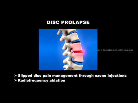 Pain Clinic Kerala | Pain Doctor Thrissur