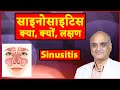 What Is Sinusitis What Is Sinusitis What Is Sinus