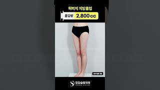 붙던 다리, 이렇게 달라짐 👆