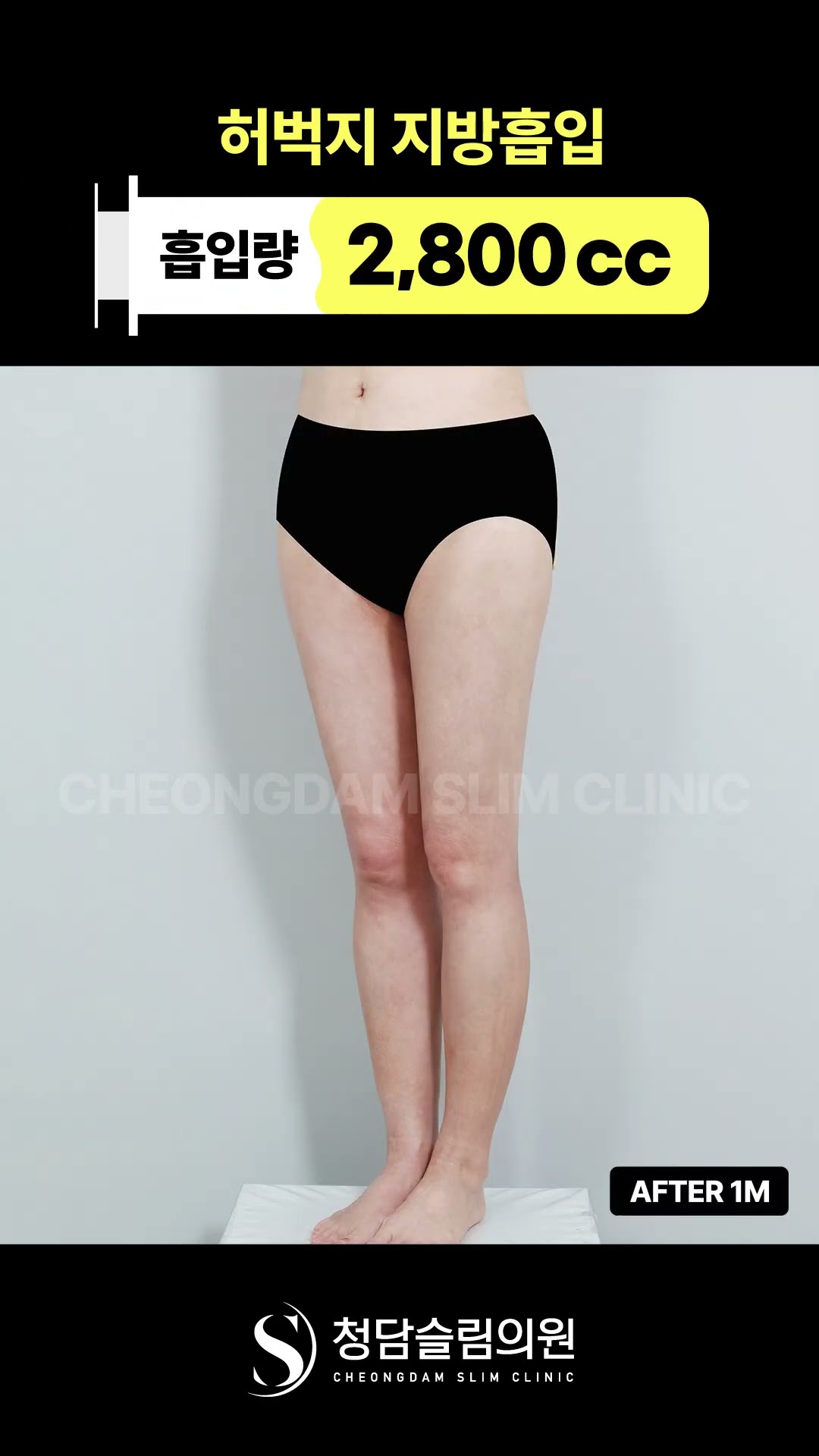 붙던 다리, 이렇게 달라짐 👆