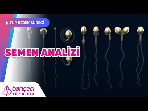 Semen Analizi