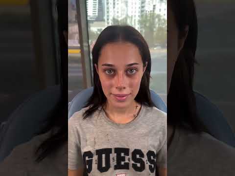 Barbie Nose vs Natural Rhinoplasty | Which Look Fits You? – Dr. Murat Benzer