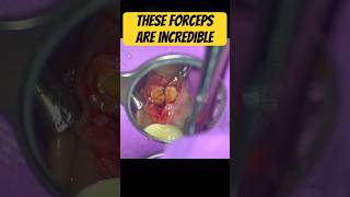 Have you TRIED these? #dentist