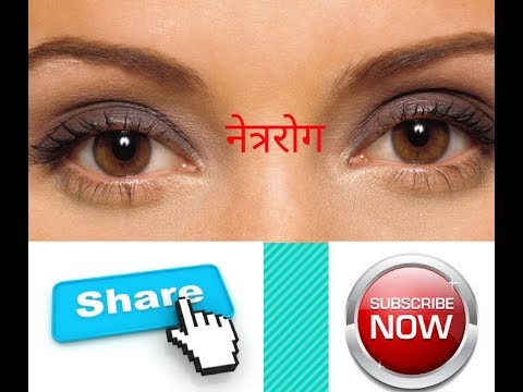 सभी तरह के आखो के रोग की दवा /all eye disease ayurvedic treatment in hindi Video